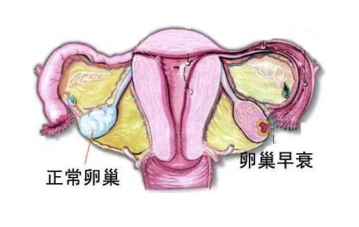 杭州三代试管助孕机构试管包成功_南京试管三代成功姐妹论坛_试管胎停后成功好孕