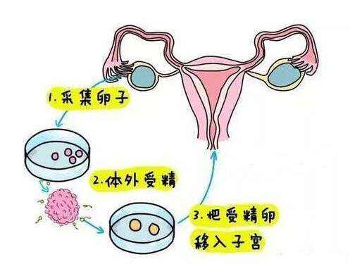 武汉助孕试管医院_人工受孕和试管孕麻烦吗_试管孕5个月胎盘早剥难免流产