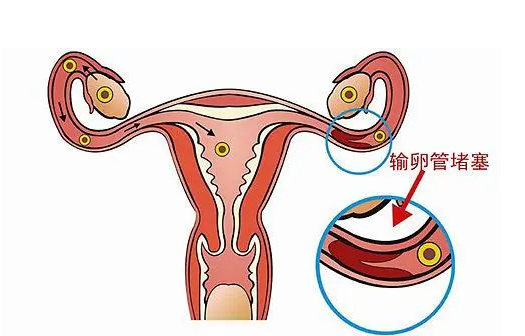 ԹֲߵھֽͼƬ_Թֲ߳ɹ_Թߵȼô