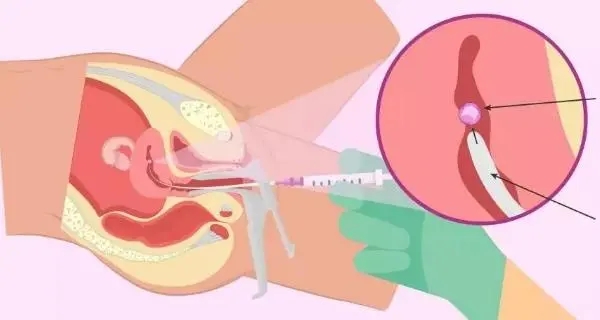 Թʲô˼_̩Թcc_Թܵɸ