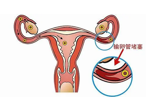 试管移植囊胚8天试纸_试管养囊胚_试管5天囊胚男孩几率