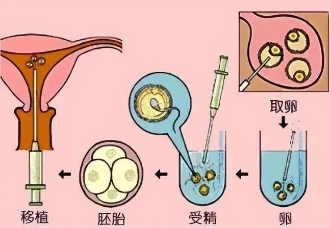 第三代试管婴儿供卵机构_45岁做供卵试管成功率_供卵试管成功率