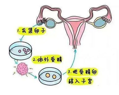 Թ_Թӷ_ԹӺȻ