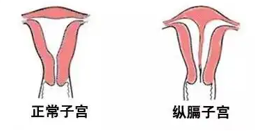 ӹѪȱʧ_˫ӹԹռ_ӹȱʧԹܳɹ