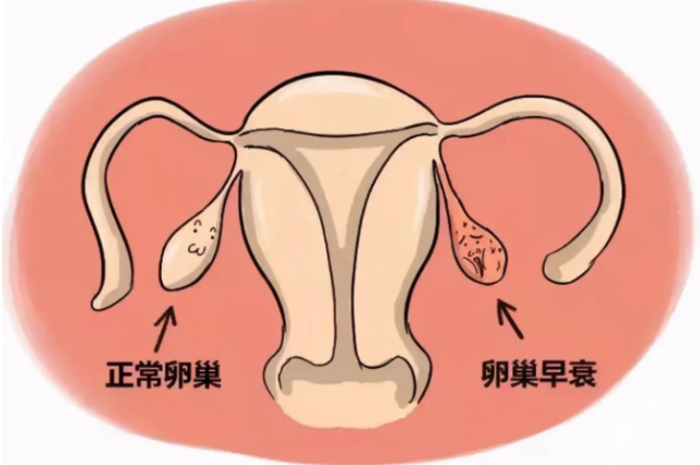 试管胚胎孵化移植成功率高吗__借卵移植